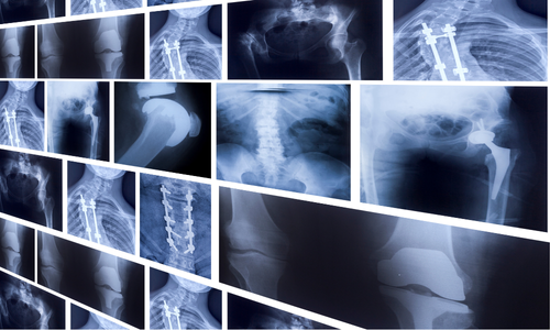 関節の痛み治療