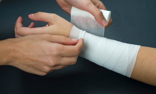 骨折・ねんざ治療