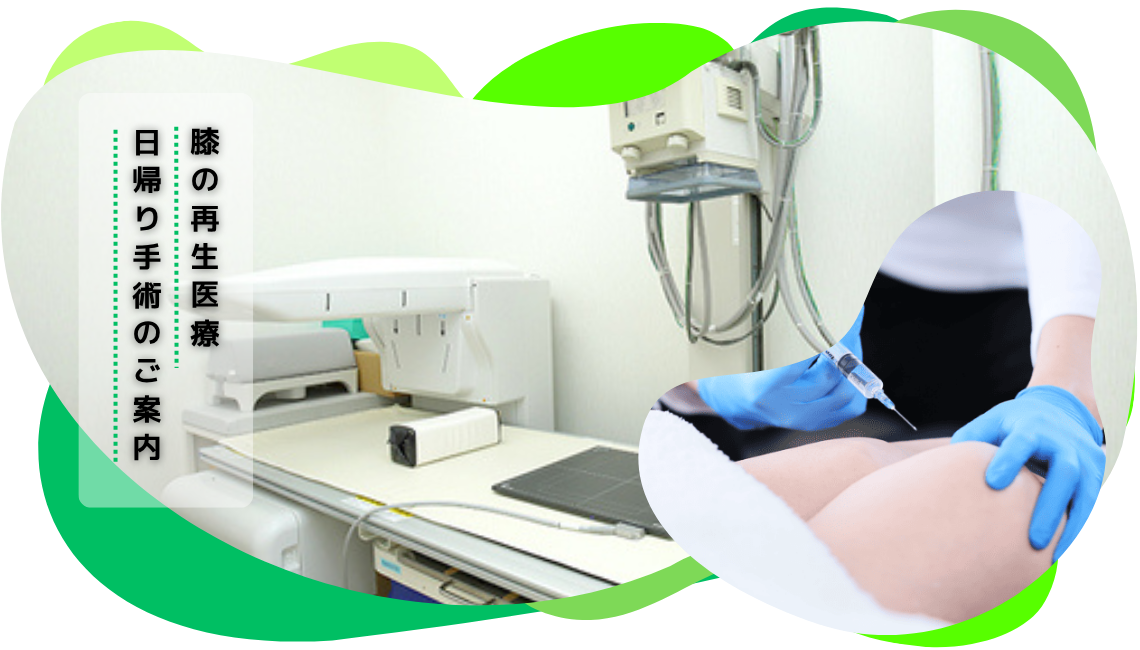 膝の再生医療・日帰り治療のご案内